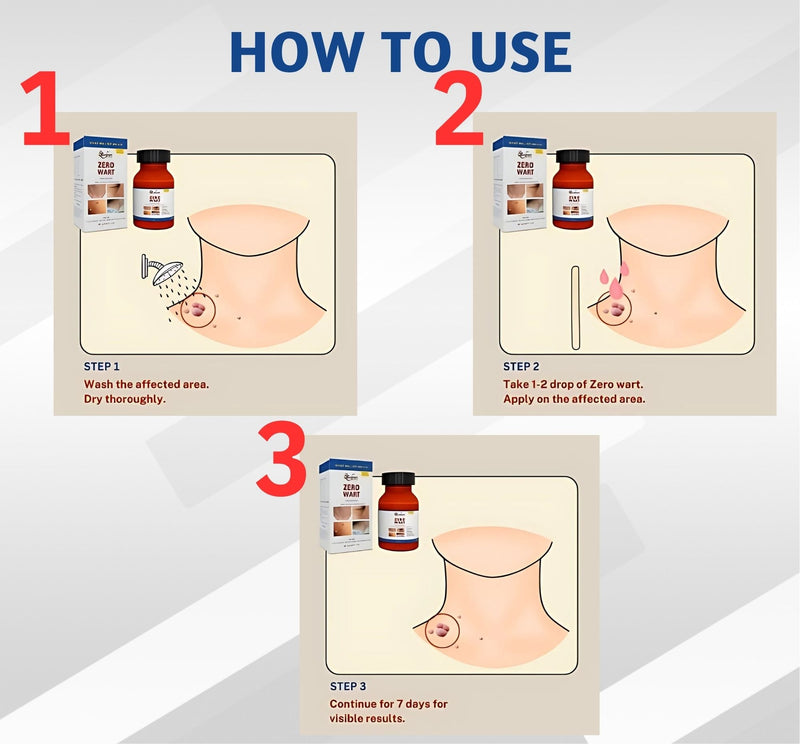 Zero Wart 5ml - Effective Wart Remover Solution (PACK OF 2)-2
